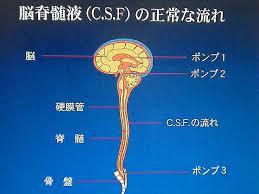 脳脊髄液　画像７